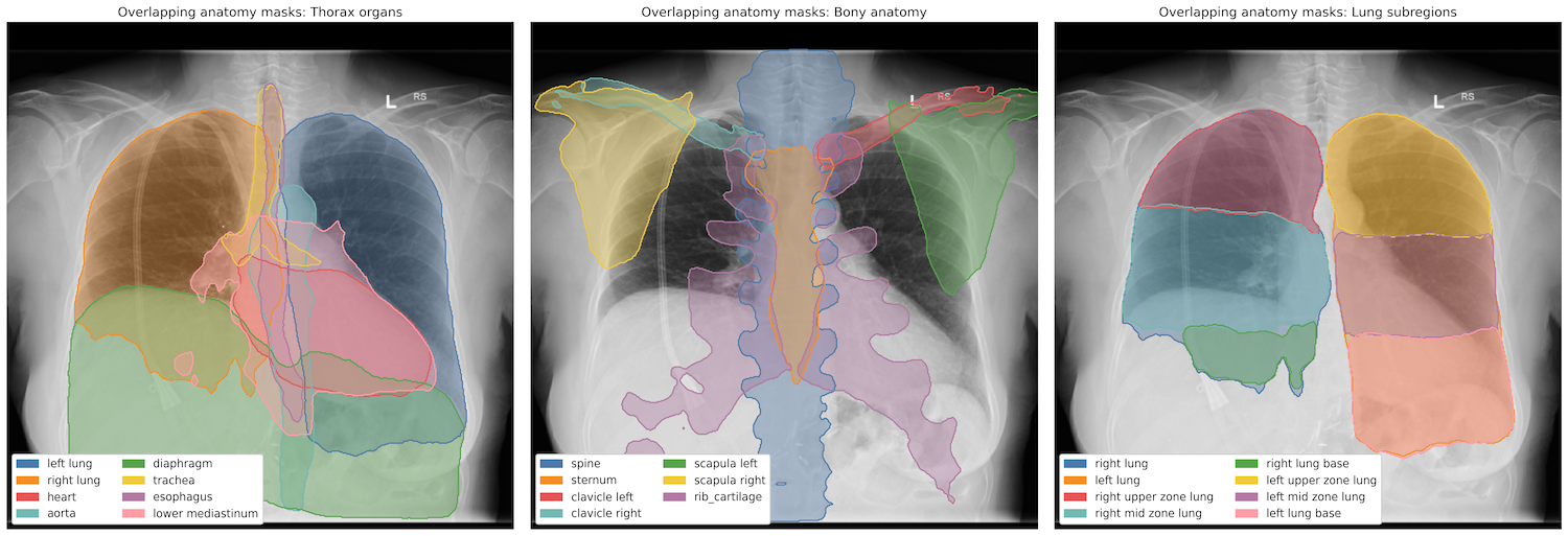 _images/segmentation-cxas.png